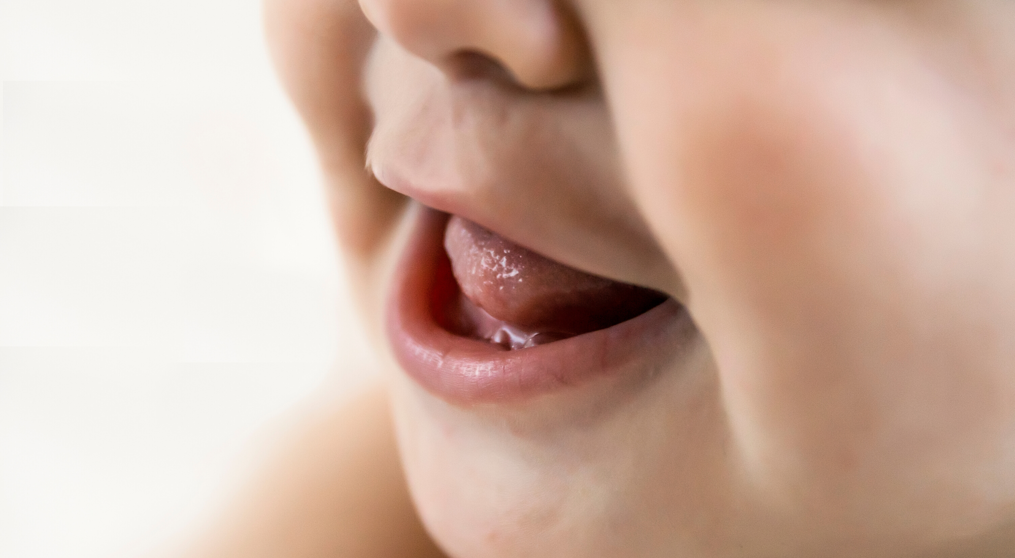 The Best Ways to Treat Thrush in Babies